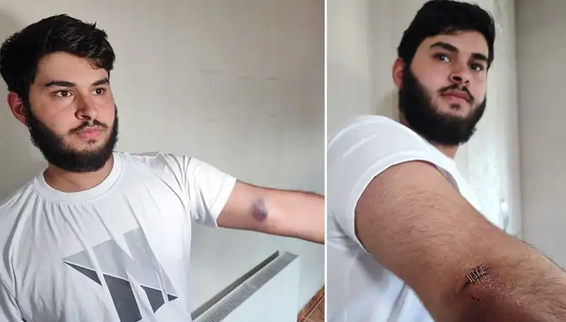 Mahalledetop kargaşası: Conolar’ın kamyonetle gelişi herkesi şaşırttı
