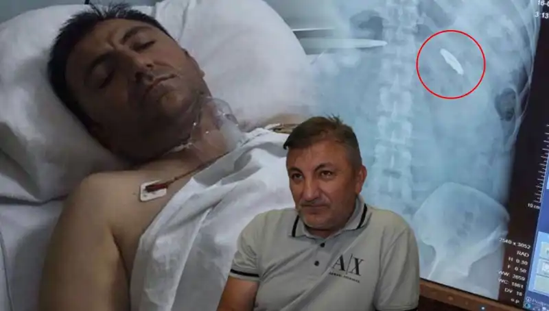 15 Temmuz Sonrası Yaşanan Acılar: Vücudunda Kurşunla 9 Yıl Geçirenlerin Hikayesi